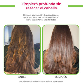 recover me shampoo sin sulfato agua de cielo antes y despues